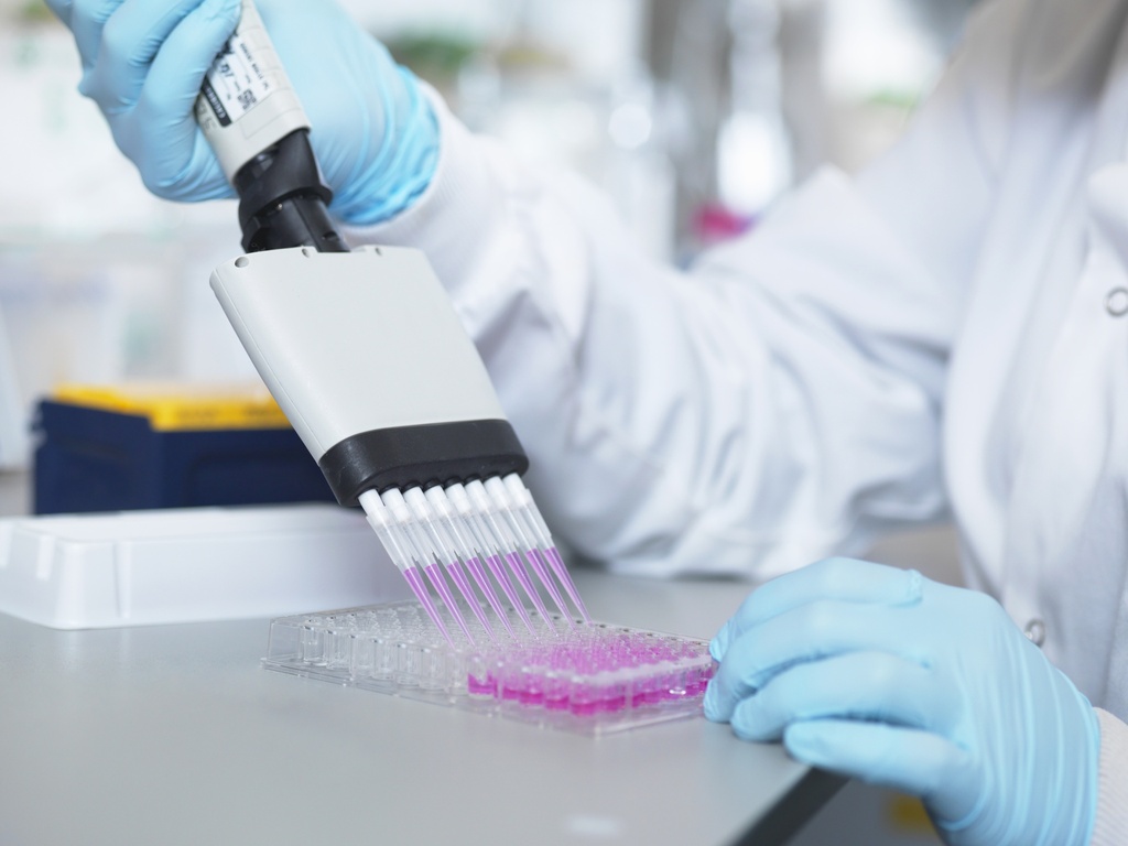   IgM ELISA Kit   